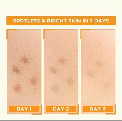 Garnier Vitamin C Serum 30ml Skin Brightening